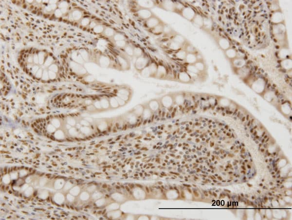 OXSR1 / OSR1 Antibody (clone 4G9)