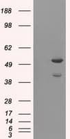 AKT2 Antibody (clone OTI8G8)