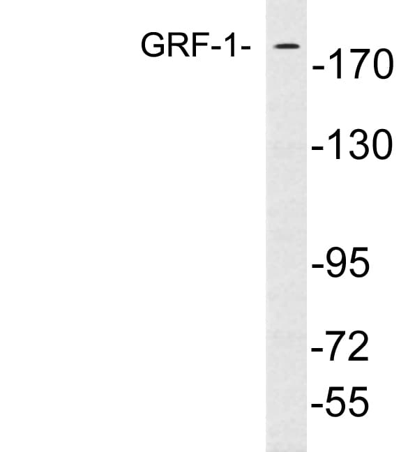 Polyclonal Rabbit anti-Human ARHGAP35 / GRLF1 Antibody (aa1032-1081, WB)