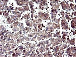 SERPINB3 Antibody (clone OTI2B11)