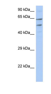 Polyclonal Rabbit anti-Human TMCC3 Antibody (N-Terminus, WB)