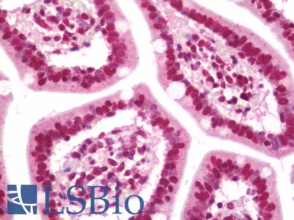 IHC-plus™ TOP1 / Topoisomerase I Antibody (aa715-765)