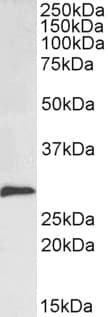IHC-plus™ SNAI1 / SNAIL-1 Antibody (aa8-19)