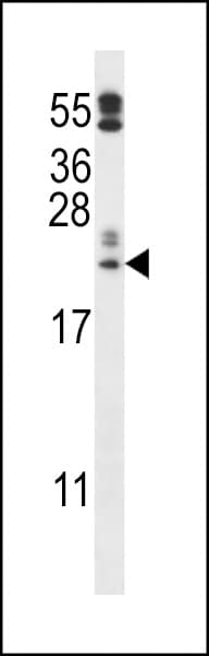 PRXL2A / FAM213A Antibody (aa181-209)