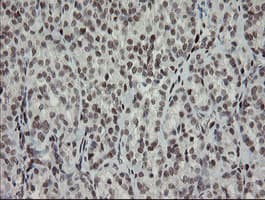 TLE1 / TLE 1 Antibody (clone OTI1D6)