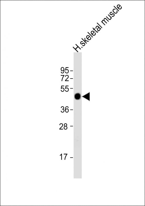 HYKK / AGPHD1 Antibody (aa65-99)