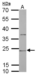 IHC-plus™ CD74 / CLIP Antibody (aa1-58)