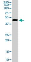 Monoclonal Mouse anti-Human TADA2B Antibody (clone 1C8, WB)
