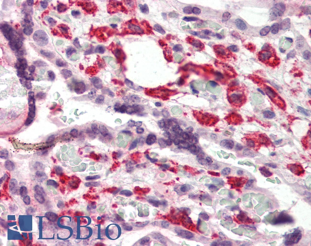IHC-plus™ Polyclonal Rabbit anti-Human DUSP1 / MKP1 Antibody (C-Terminus, IHC, WB)