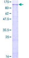 Human PLD2 / Phospholipase D2 Protein (Recombinant GST)