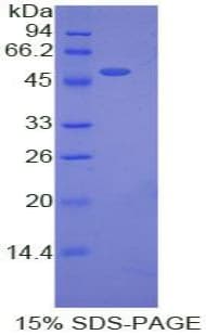 Pig EPO / Erythropoietin Protein (Recombinant His-GST)