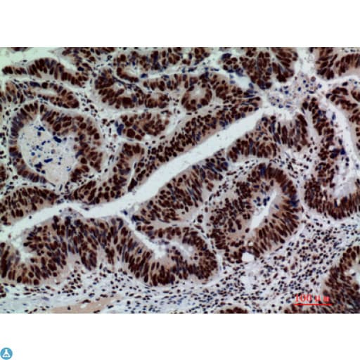 Polyclonal Rabbit anti-Human GLB1 / Beta-Galactosidase Antibody (IHC, WB)