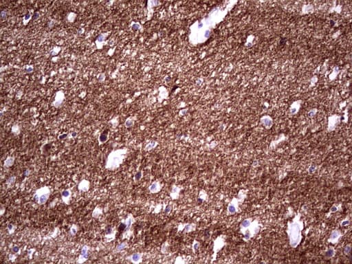 NCAM / CD56 Antibody (aa20-718, clone OTI2F6)