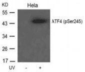 Polyclonal Rabbit anti-Human ATF4 Antibody (IHC, WB)
