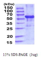 Human IFIT3 Protein (Recombinant His)