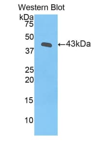 PGF / PLGF Antibody (aa19-158)