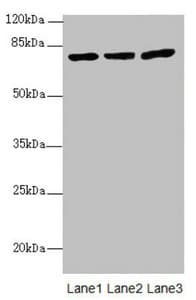 KBTBD7 Antibody