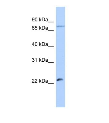HSFY2 Antibody (aa51-100)