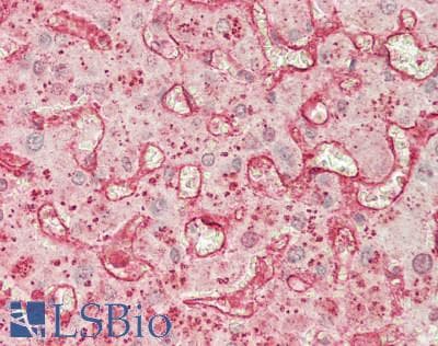 IHC-plus™ CD209 / DC-SIGN Antibody (clone 8B6)