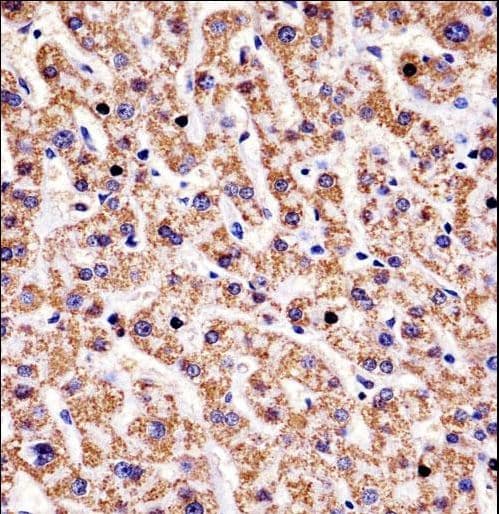 HYAL1 Antibody (aa280-309)