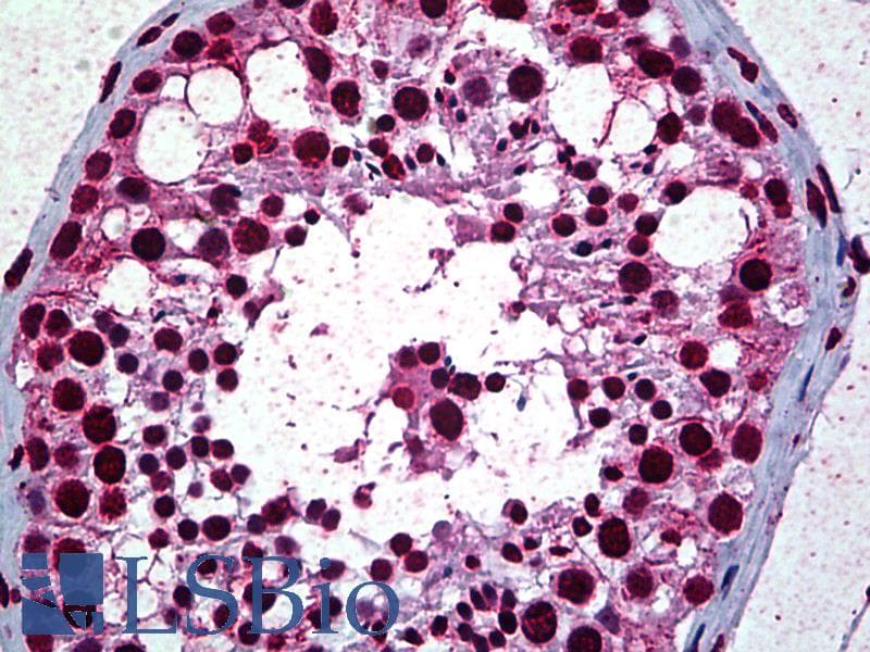 IHC-plus™ RBBP4 / RBAP48 Antibody (clone 2D7)