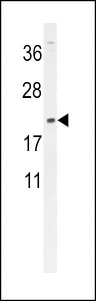 DMRTC1 Antibody (aa6-34)