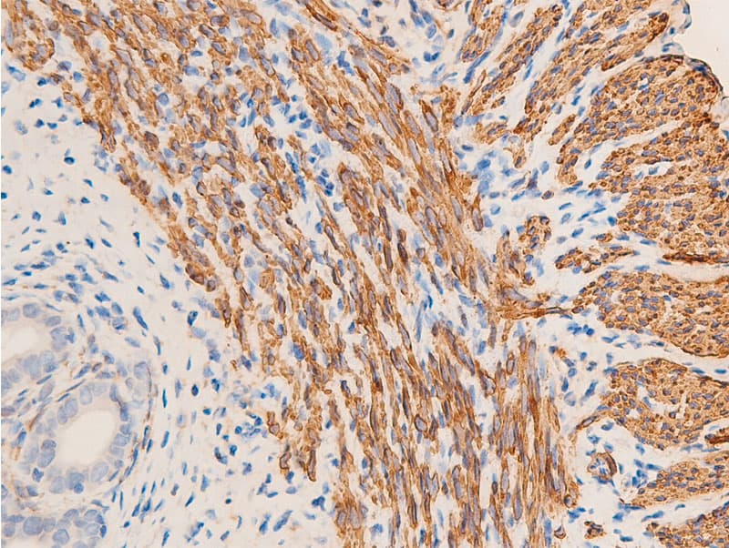 ACTA2 / Smooth Muscle Actin Antibody