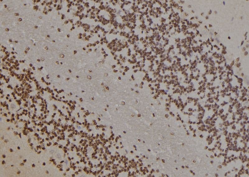 PARP1 Antibody