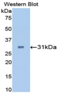 CA2 / Carbonic Anhydrase II Antibody (aa1-260)
