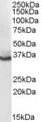 IHC-plus™ AKR1C4 / Chlordecone Reductase Antibody (aa2-14)