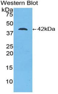 CKB / Creatine Kinase BB Antibody (aa11-367)