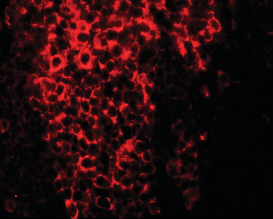 IHC-plus™ CRTR1 / TFCP2L1 Antibody