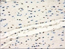 Monoclonal Mouse anti-Human FRK Antibody (clone OTI6D2, IHC, IF, WB)