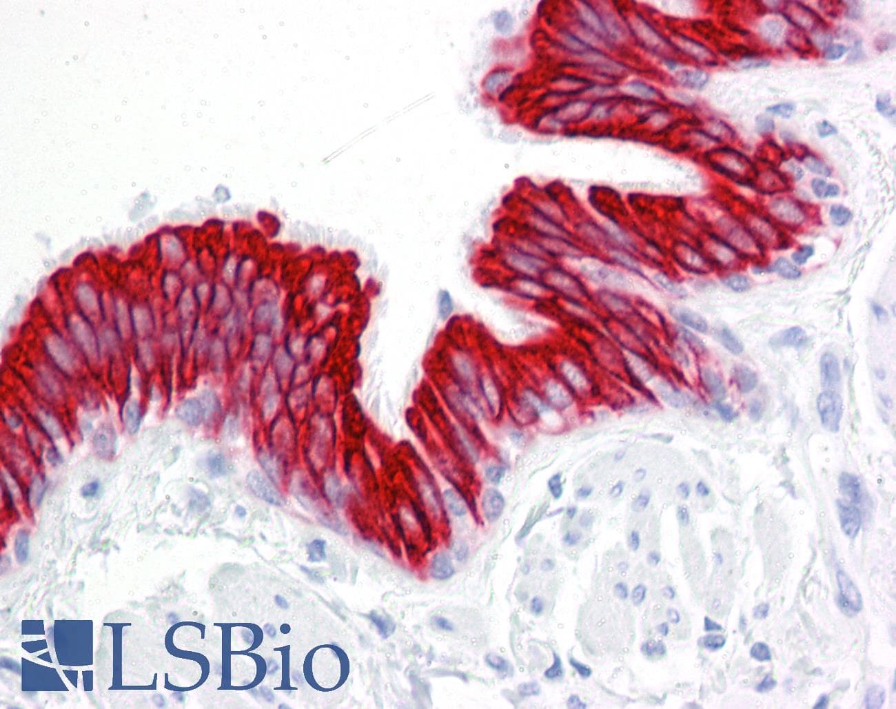 PathPlus™ Monoclonal Mouse anti-Human KRT18 / CK18 / Cytokeratin 18 Antibody (clone RCK106, IHC, WB)