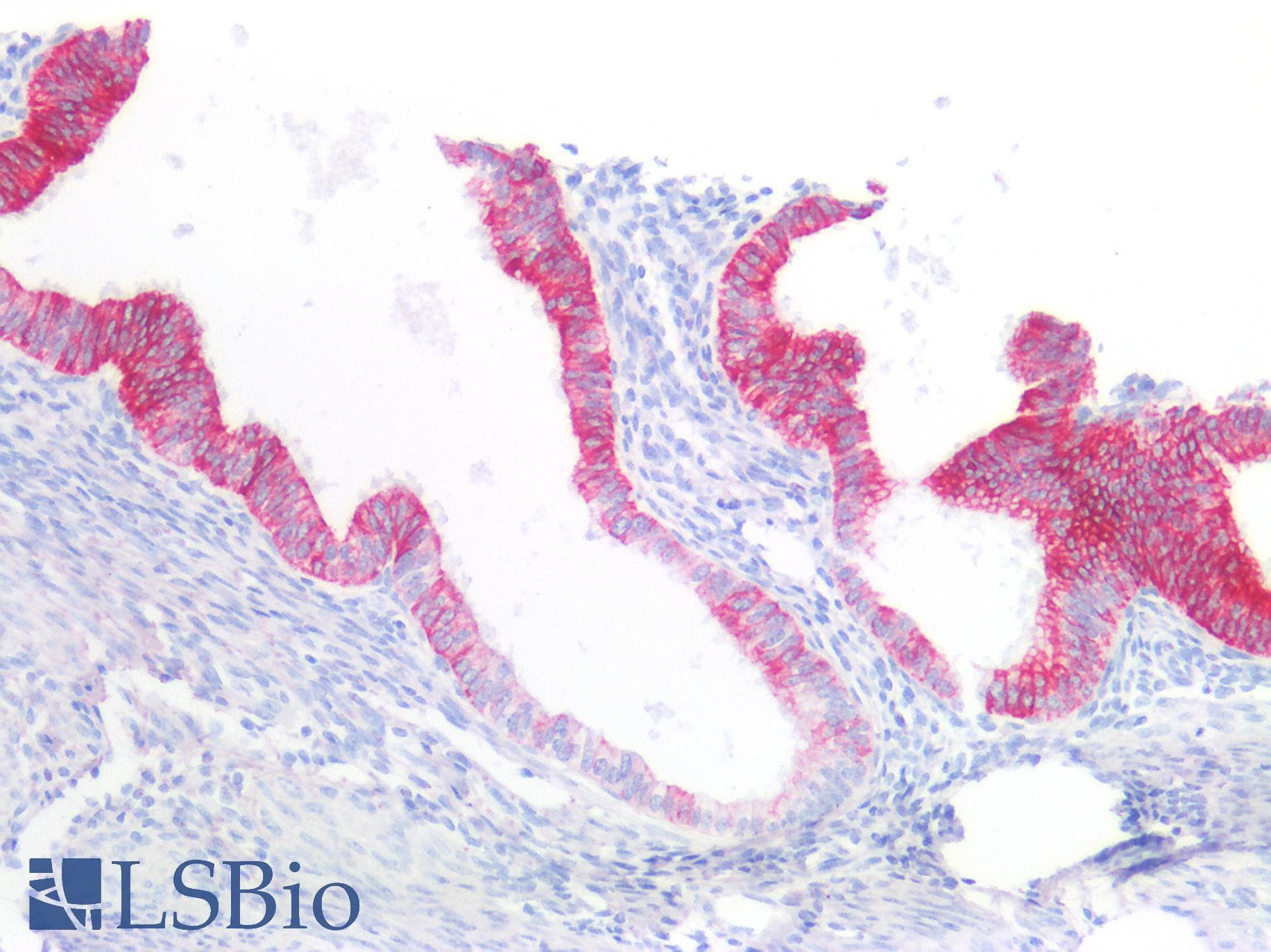PathPlus™ Monoclonal Mouse anti-Human KRT7 / CK7 / Cytokeratin 7 Antibody (IHC, WB)