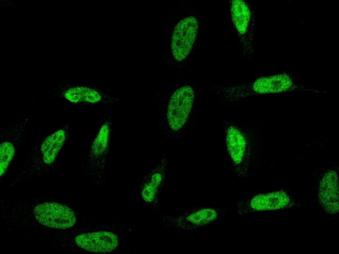 RPRD1B Antibody (clone 12, Preservative Free)