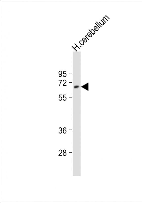 Polyclonal Rabbit anti-Human UGT2B4 Antibody (aa338-370, WB)