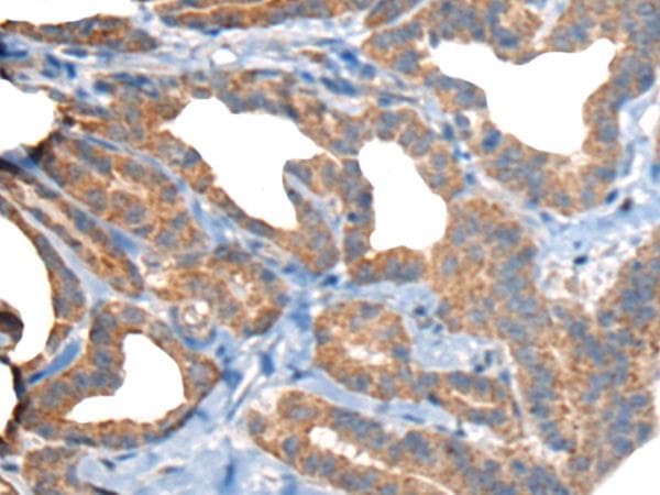 Polyclonal Rabbit anti-Human RTN4IP1 / NIMP Antibody (IHC)