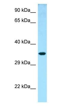 NTHL1 Antibody (aa91-140)