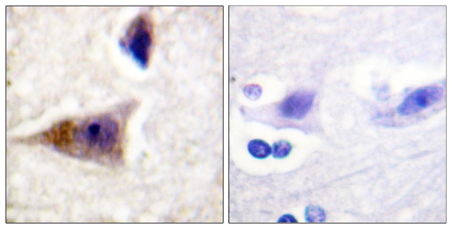 CASP1 / Caspase 1 Antibody (phospho-Ser376)