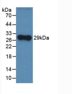 CFH / Complement Factor H Antibody (Biotin)