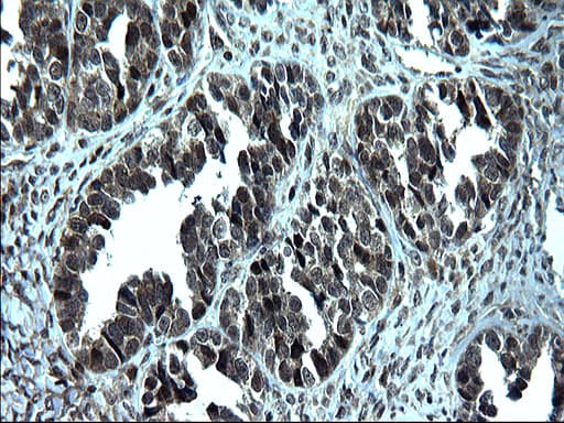 ZFAND3 / TEX27 Antibody (clone OTI1C5)
