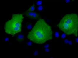 AK5 / Adenylate Kinase 5 Antibody (clone OTI1C5)