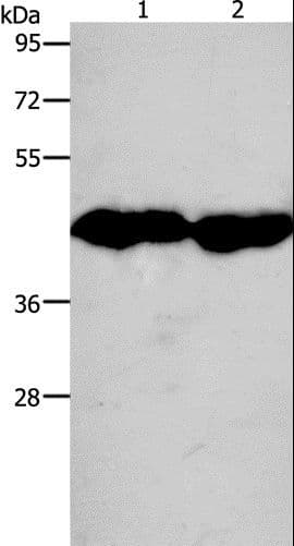 CKM / Creatine Kinase MM Antibody