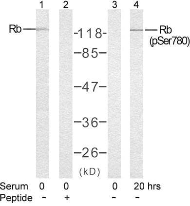 RB1 / Retinoblastoma / RB Antibody (p780)