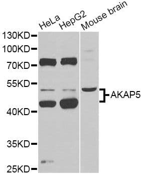 Polyclonal Rabbit anti-Human AKAP5 / AKAP79 Antibody (WB)