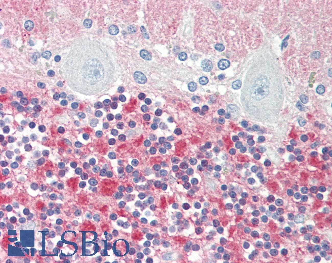 IHC-plus™ Polyclonal Rabbit anti-Human VILIP / VSNL1 Antibody (aa47-75, IHC, WB)