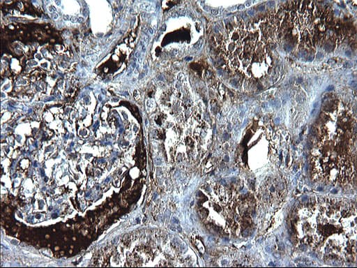 FGG / Fibrinogen Gamma Antibody (clone OTI4D3)