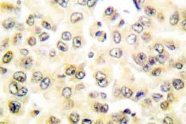 STAT5A Antibody (phospho-Ser726)