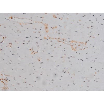 Polyclonal Rabbit anti-Human LYN Antibody (phospho-Tyr508, IHC, IF, WB)